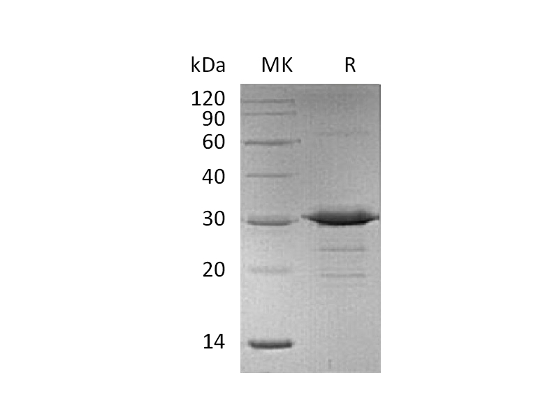 Recombinant Mouse Acrp30 (N-6His)