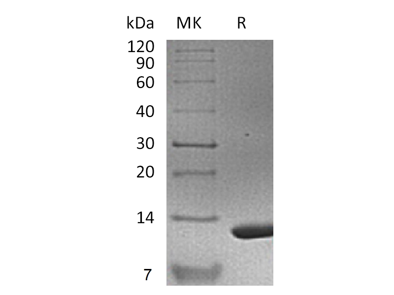 Recombinant Mouse S100A11 (N-6His)