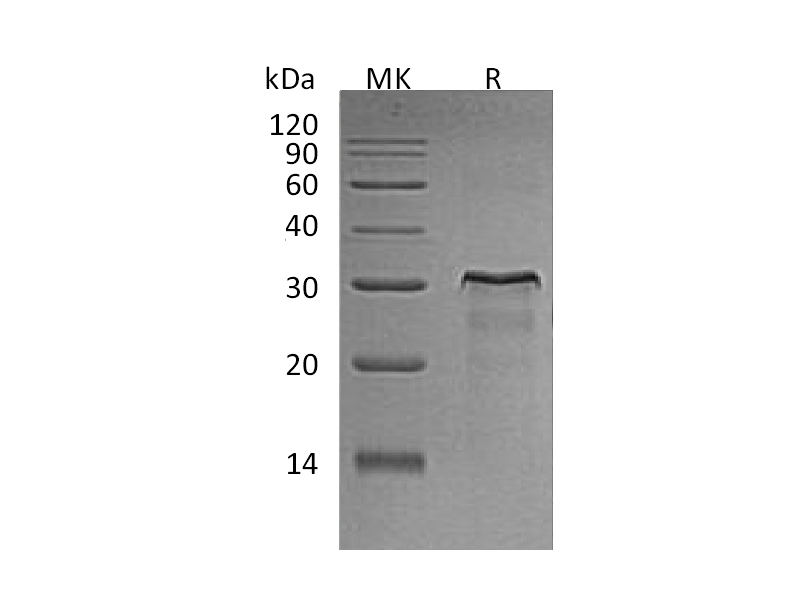 Recombinant Rat HER2 (C-6His)
