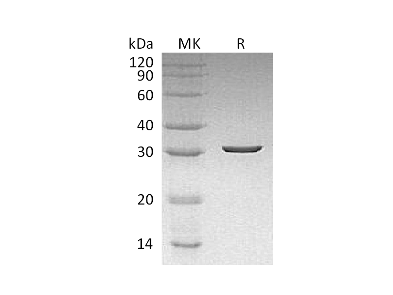 Recombinant Dechloromonas aromatica Cld (N-6His)