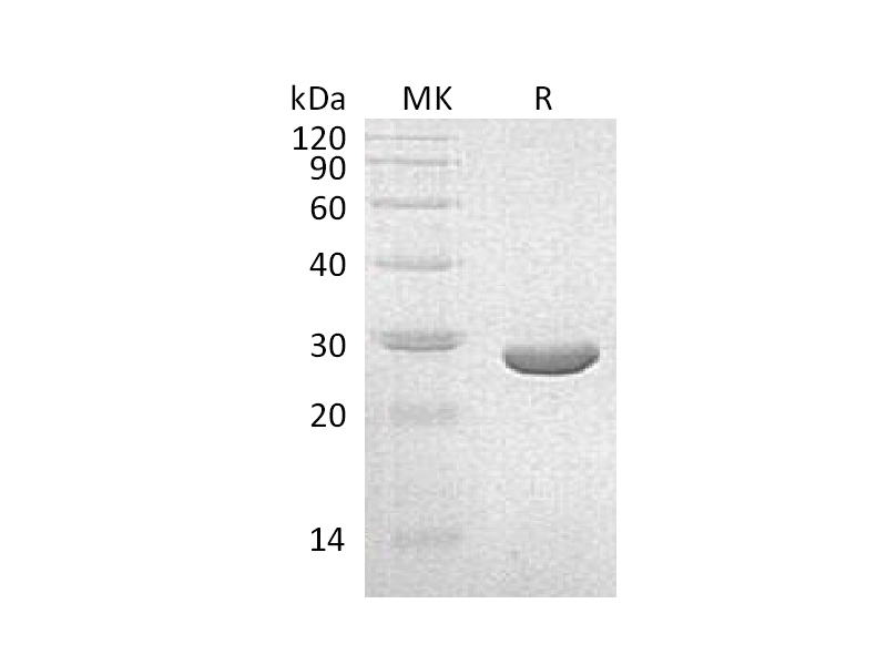 Recombinant K. pneumoniae NEO