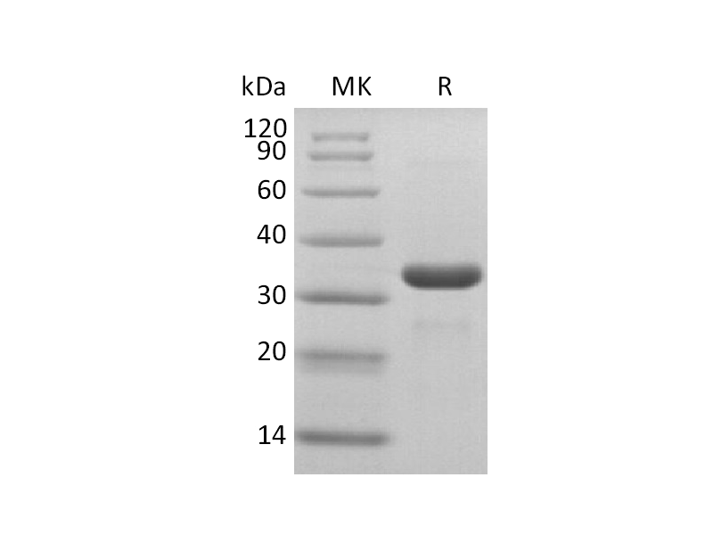 Recombinant SARS-CoV-2 3C-like Proteinase (N-6His)