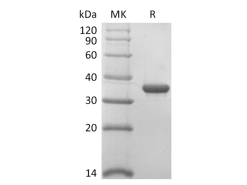 Recombinant SARS-CoV-2 Papain-Like Protease