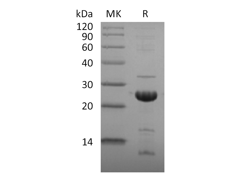 Recombinant SARS-CoV-2 NSP1 (C-6His)