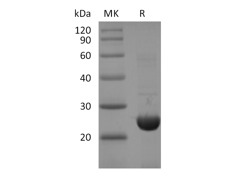 Recombinant SARS-CoV-2 NSP8 (C-6His)