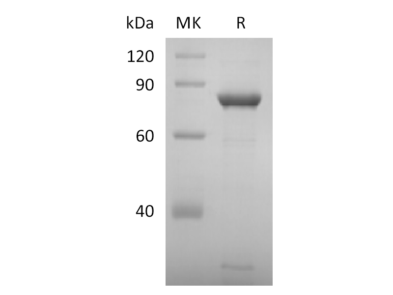 Recombinant SARS-CoV-2 NSP2 (C-6His)