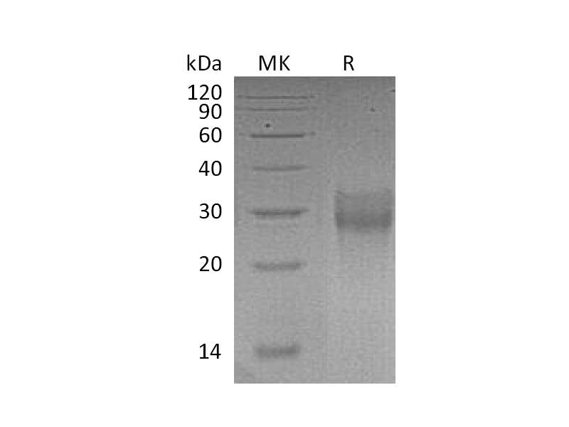 Recombinant Human 4-1BB (C-6His)