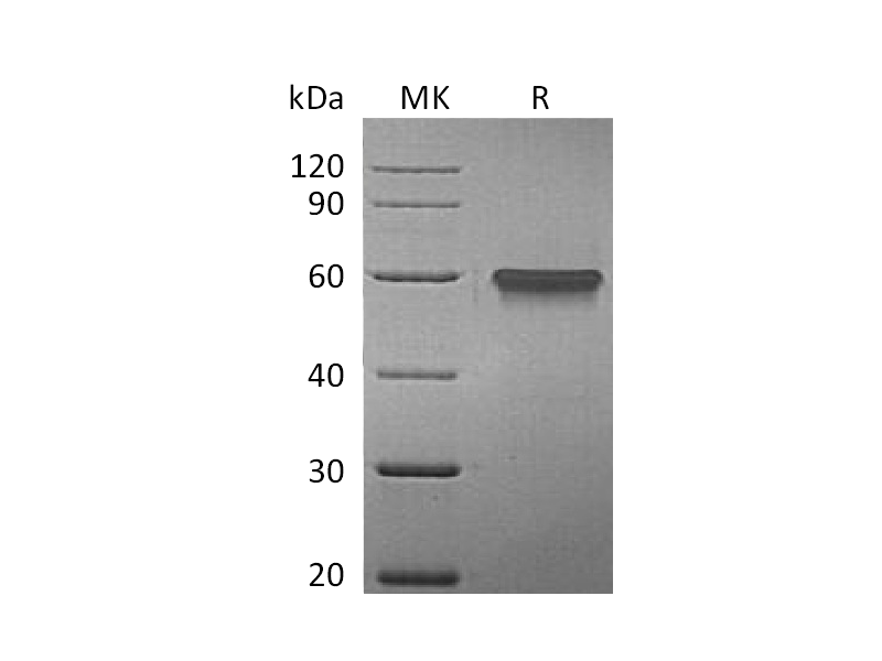 Recombinant Human 4-1BB (C-Fc)