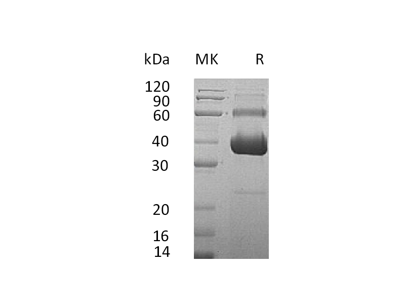 Recombinant Human ACVR2A (C-Fc-6His)