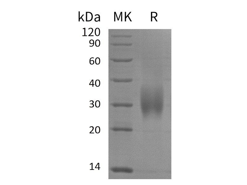 Recombinant Human ACVR2B (C-6His)