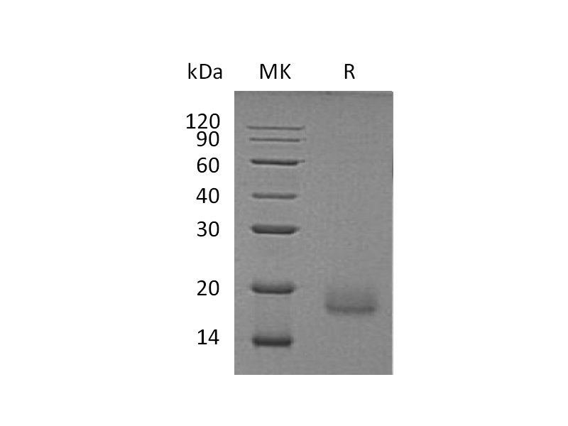 Recombinant Human ACVR1 (C-6His)