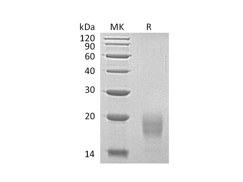 Recombinant Human ACVR1B (C-6His)