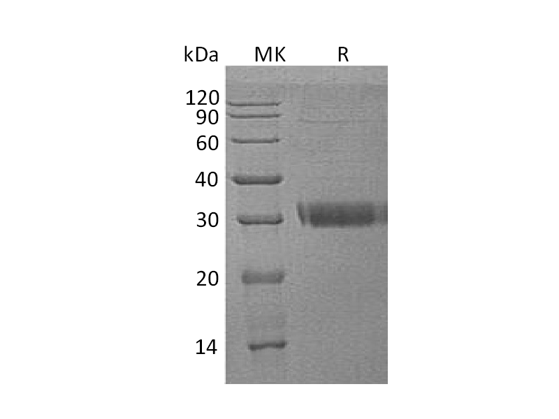 Recombinant Human Acrp30 (C-6His)
