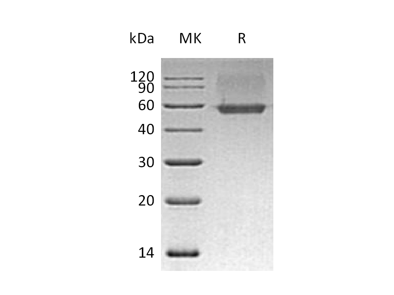 Recombinant Human AGER (C-6His)