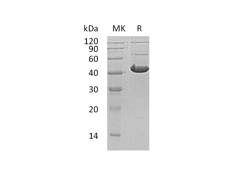 Recombinant Human ADH7 (C-6His)
