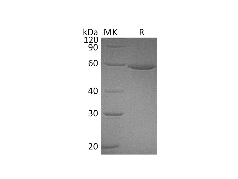 Recombinant Human ALDH3A1 (C-6His)