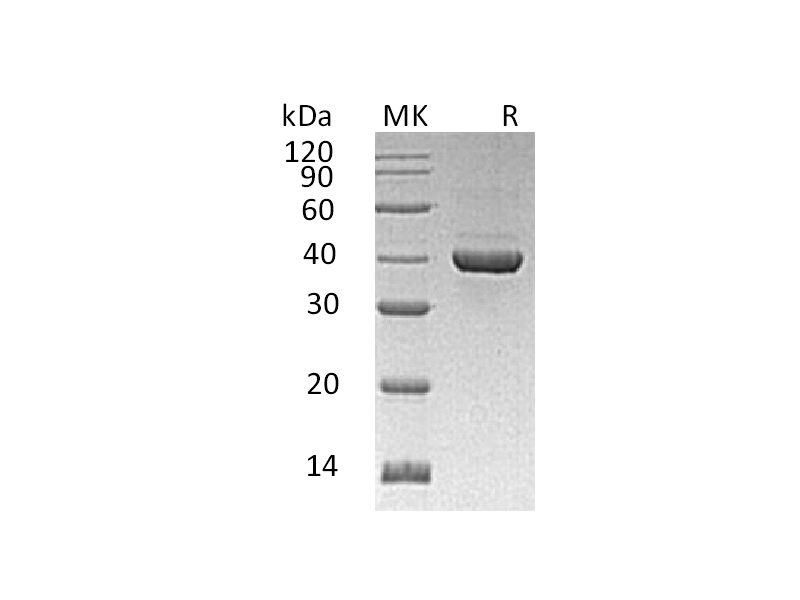 Recombinant Human ALDOC (C-6His)