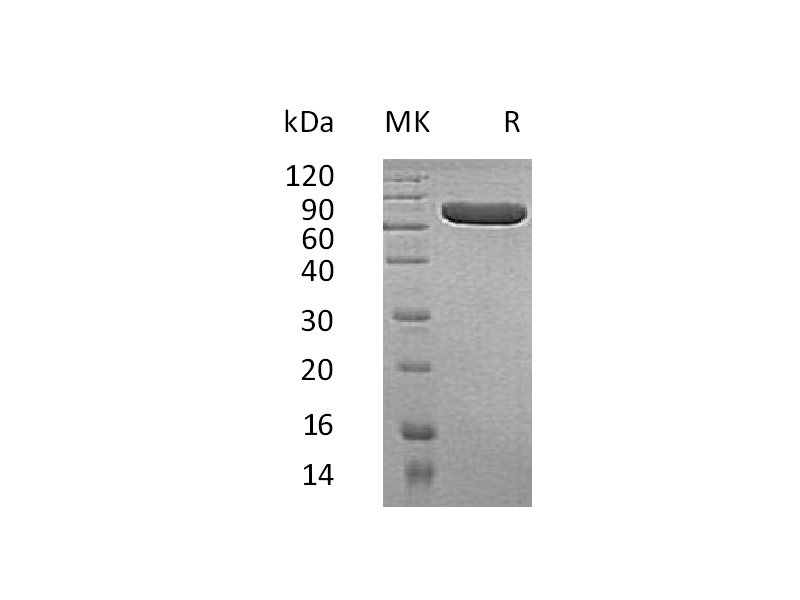 Recombinant Human ALPP (C-6His)