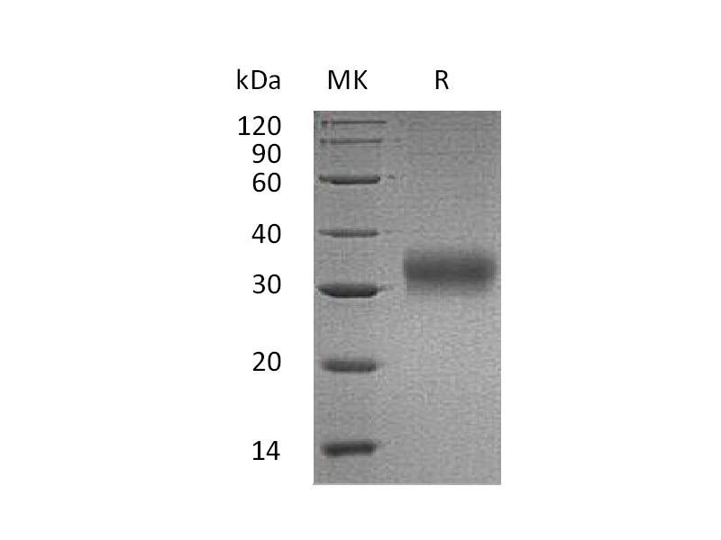 Recombinant Human AMBP (C-6His)