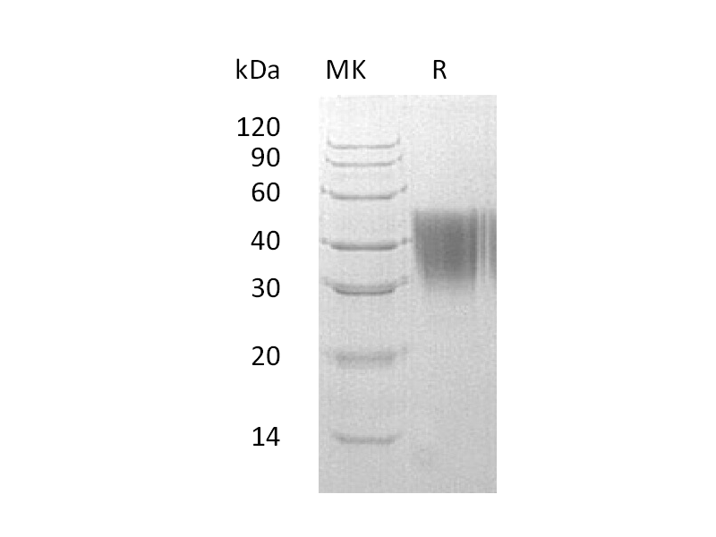 Recombinant Human AGP2 (C-6His)