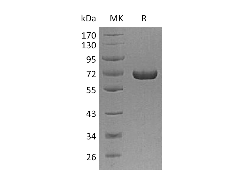 Recombinant Human AFP (C-6His)