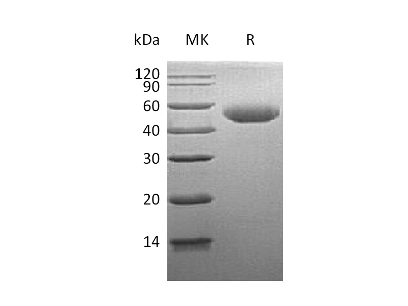 Recombinant Human GLA (C-6His)