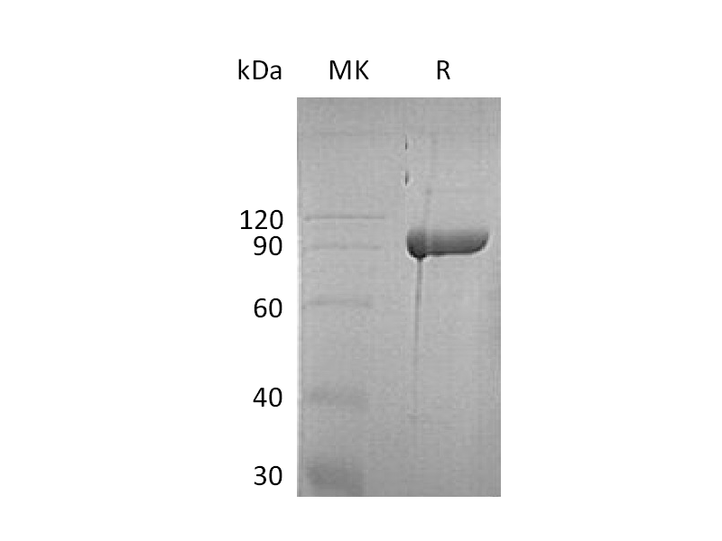 Recombinant Human ABP1 (C-6His)