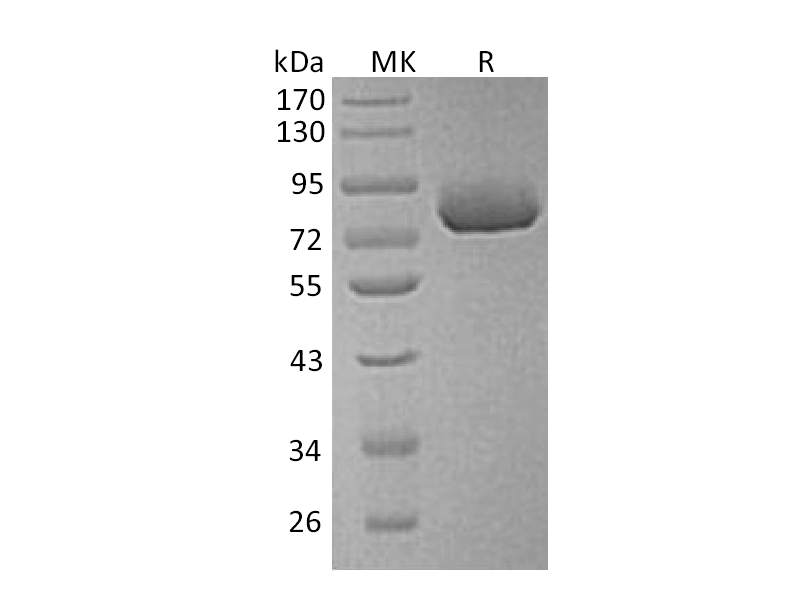 Recombinant Human XPNPEP2 (C-6His)