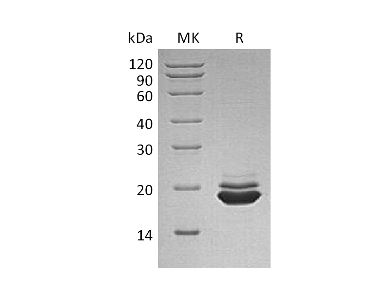 Recombinant Human APLP-1 (C-6His)