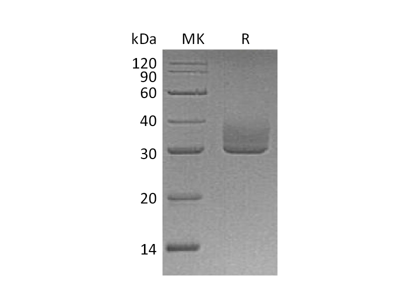 Recombinant Human ANGPTL3 (C-6His)