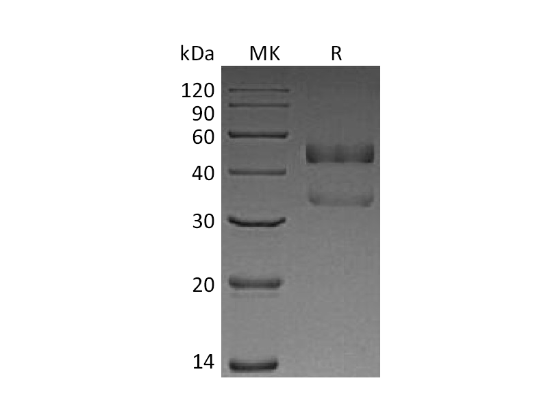 Recombinant Human ANGPTL7 (C-10His)