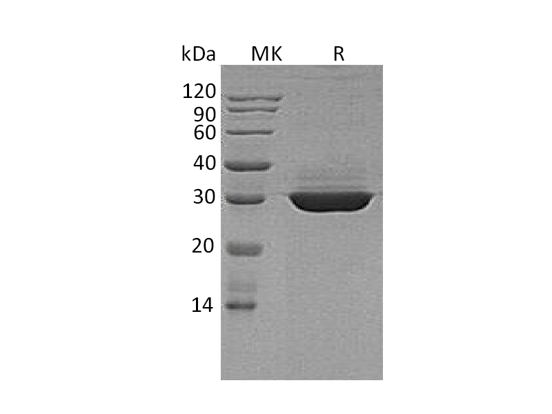Recombinant Human ApoA1 (C-6His)