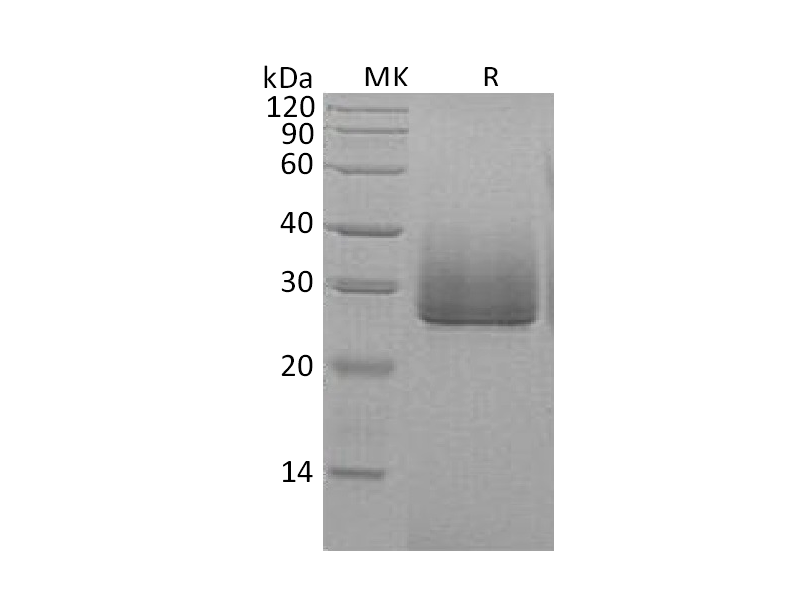 Recombinant Human ApoD (C-6His)