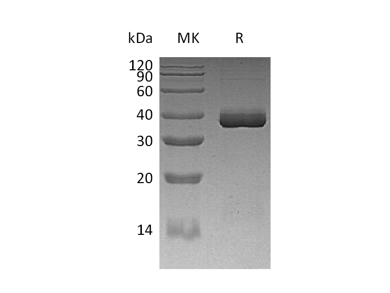 Recombinant Human ApoE3 (C-6His)