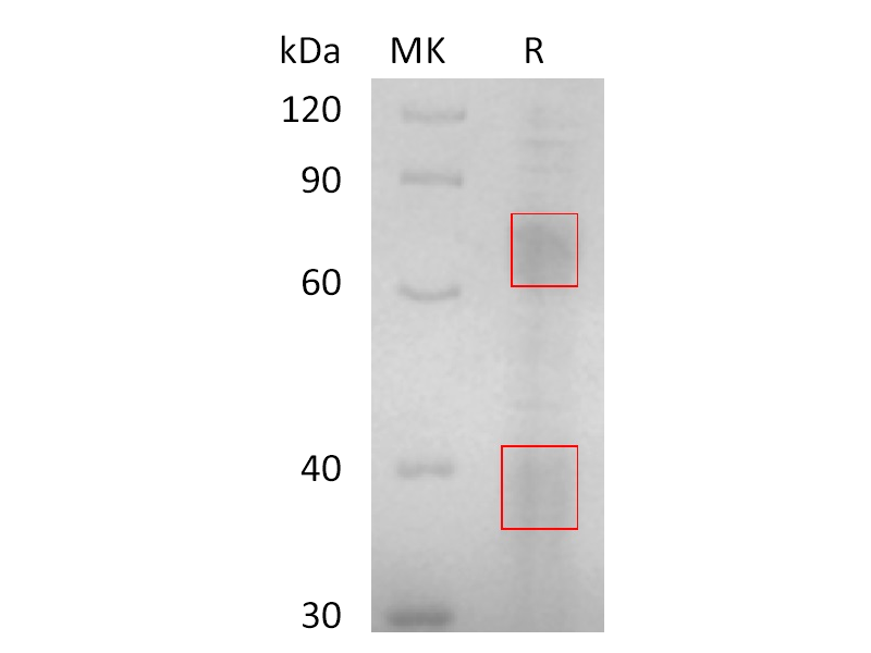Recombinant Human Clusterin (C-Fc-6His)