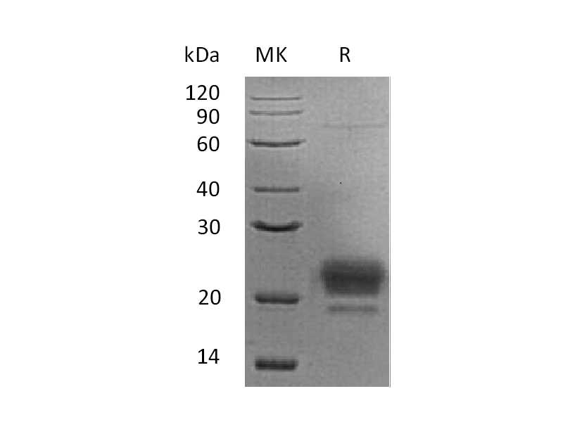 Recombinant Human ApoM (C-6His)