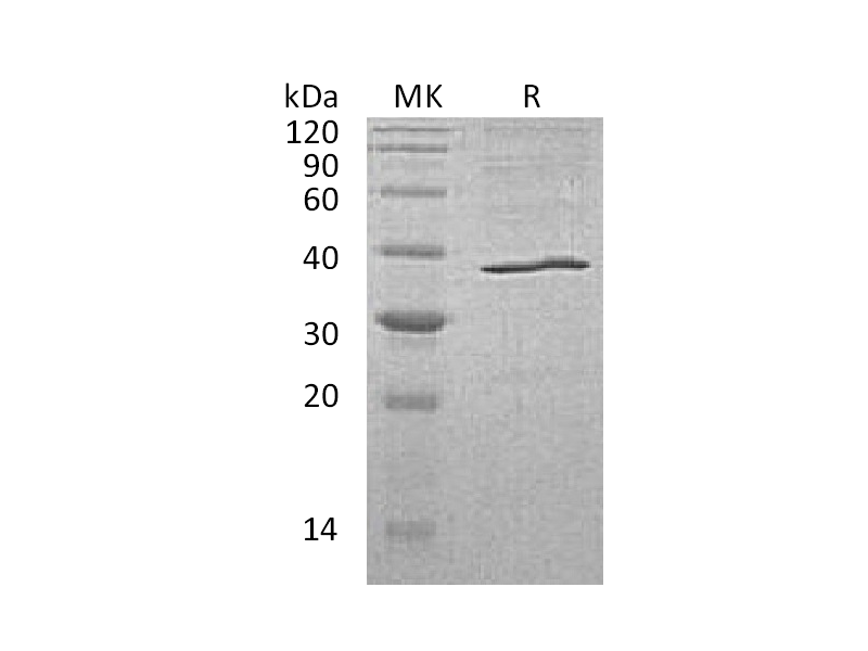 Recombinant Human AKR1C3 (C-6His)