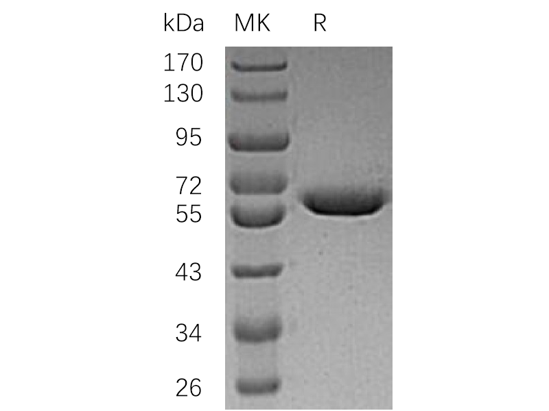Recombinant Human ARSA (C-6His)