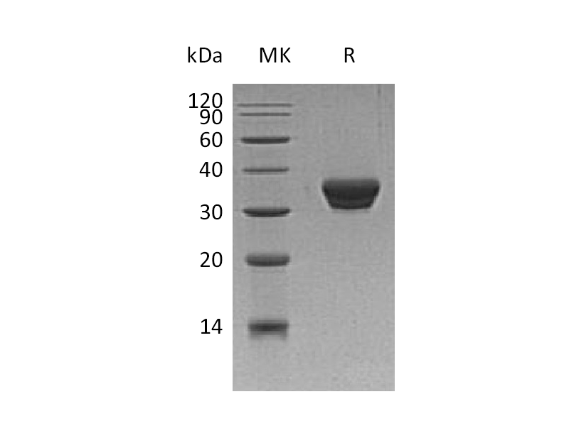 Recombinant Human ASAM (C-6His)