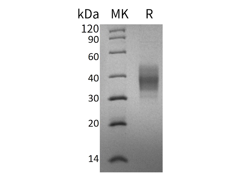Recombinant Human ASGPR1 (C-6His)