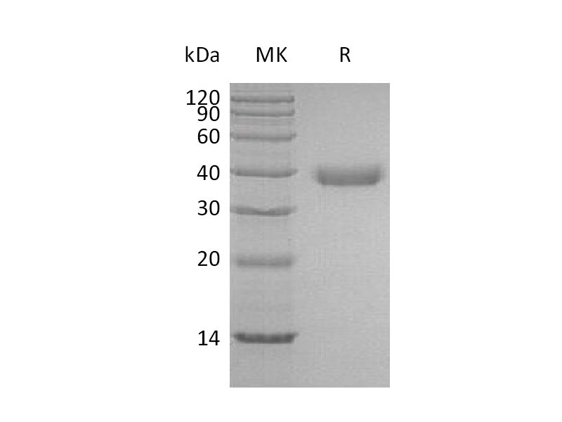 Recombinant Human Azurocidin (C-6His)