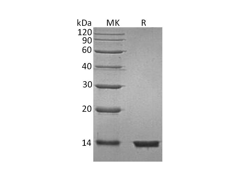 Recombinant Human B2M (C-6His)