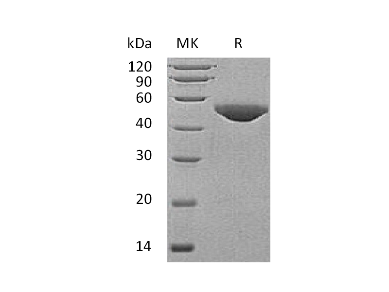 Recombinant Human B3GNT1 (C-6His)