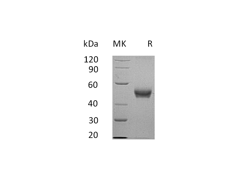 Recombinant Human B4GALT3 (C-6His)