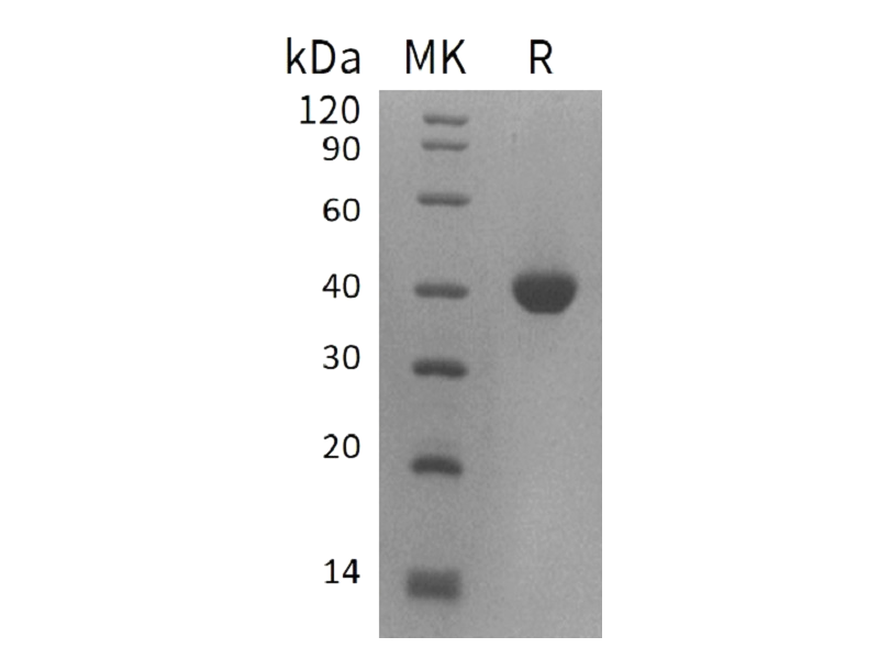 Recombinant Human B4GALT4 (C-6His)