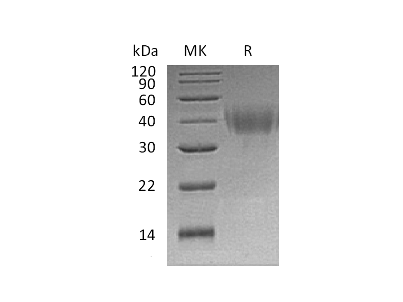 Recombinant Human PD-L2 (C-6His)