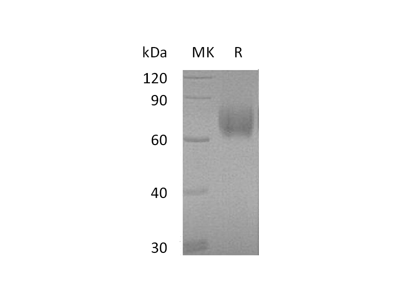 Recombinant Human B7-H3 (C-6His)