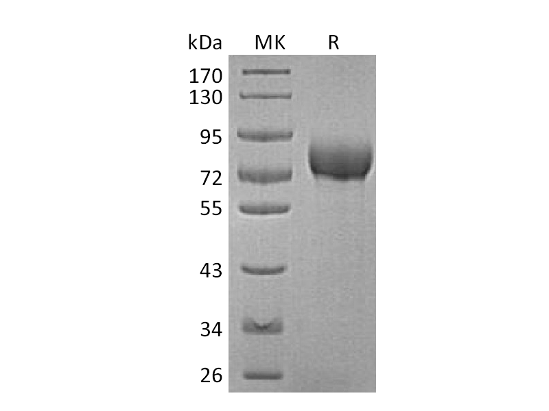 Recombinant Human BCAM (C-6His)