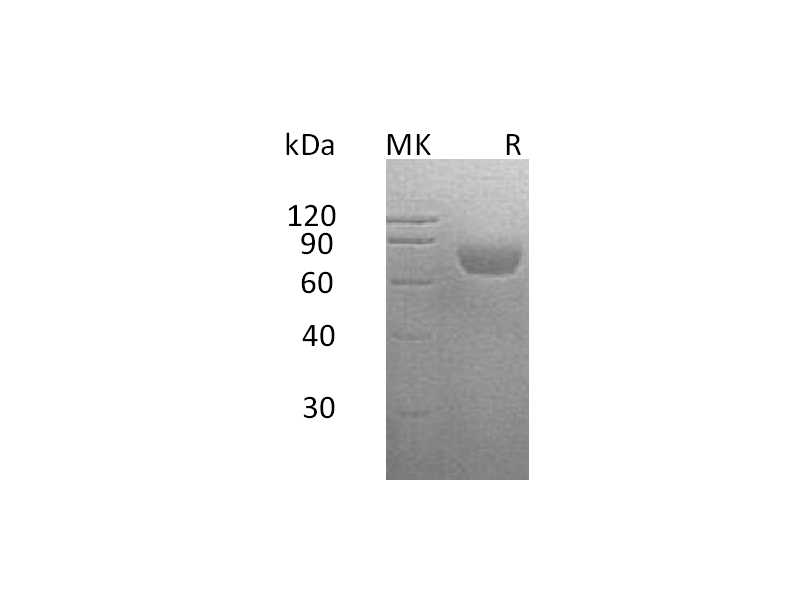 Recombinant Human SLAMF2 (C-Fc-6His)