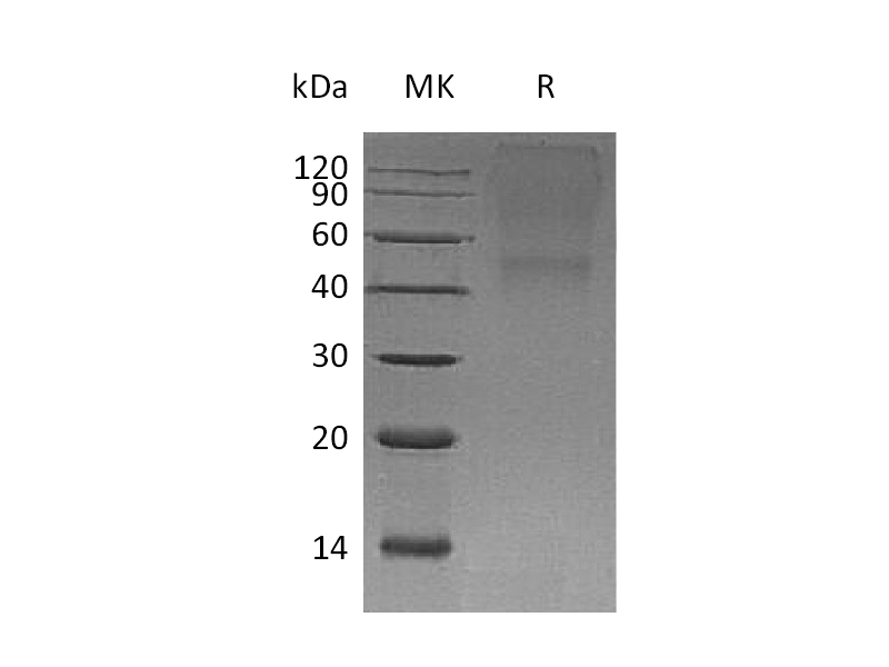 Recombinant Human BGN (C-6His)